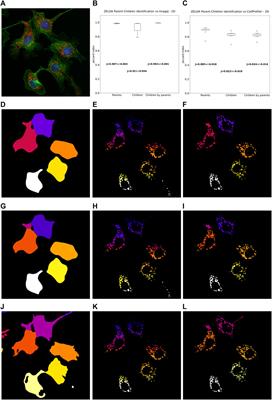 ZELDA: A 3D Image Segmentation and Parent-Child Relation Plugin for Microscopy Image Analysis in napari